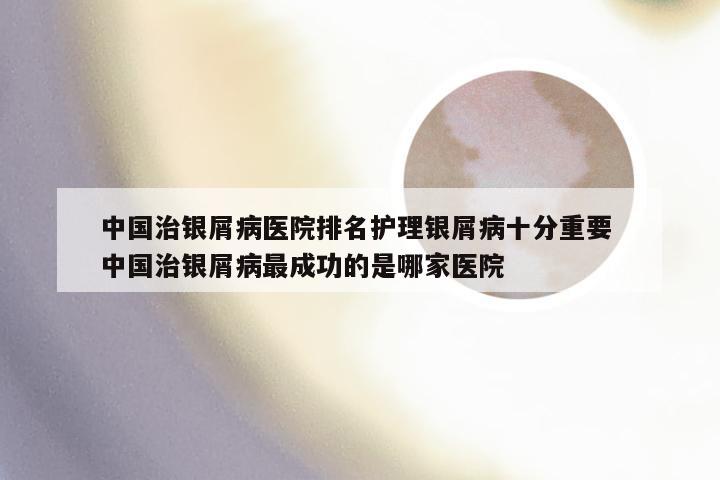 中国治银屑病医院排名护理银屑病十分重要 中国治银屑病最成功的是哪家医院
