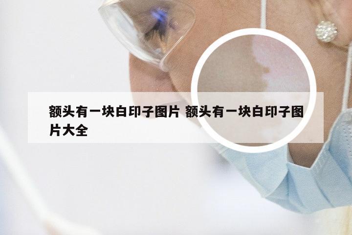额头有一块白印子图片 额头有一块白印子图片大全