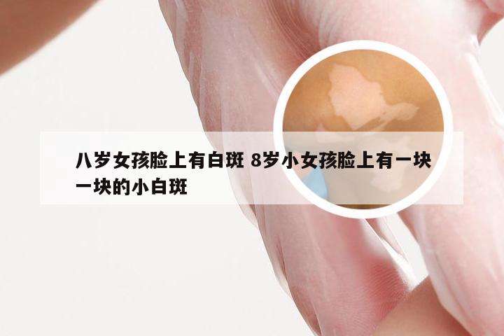 八岁女孩脸上有白斑 8岁小女孩脸上有一块一块的小白斑