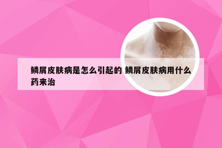 鳞屑皮肤病是怎么引起的 鳞屑皮肤病用什么药来治