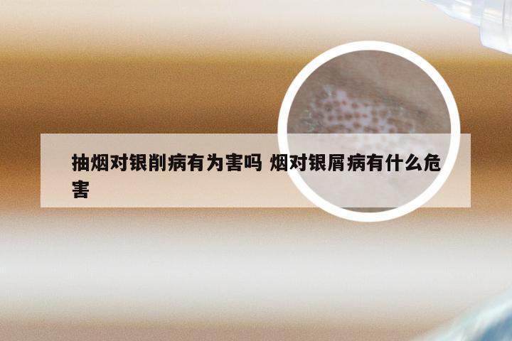 抽烟对银削病有为害吗 烟对银屑病有什么危害