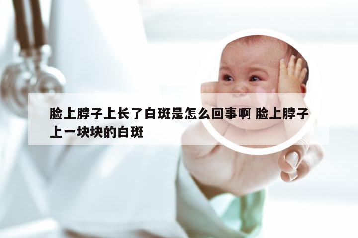 脸上脖子上长了白斑是怎么回事啊 脸上脖子上一块块的白斑