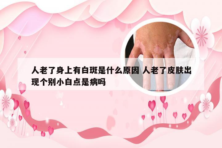 人老了身上有白斑是什么原因 人老了皮肤出现个别小白点是病吗