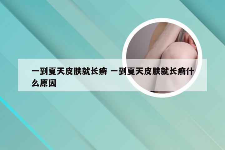 一到夏天皮肤就长癣 一到夏天皮肤就长癣什么原因