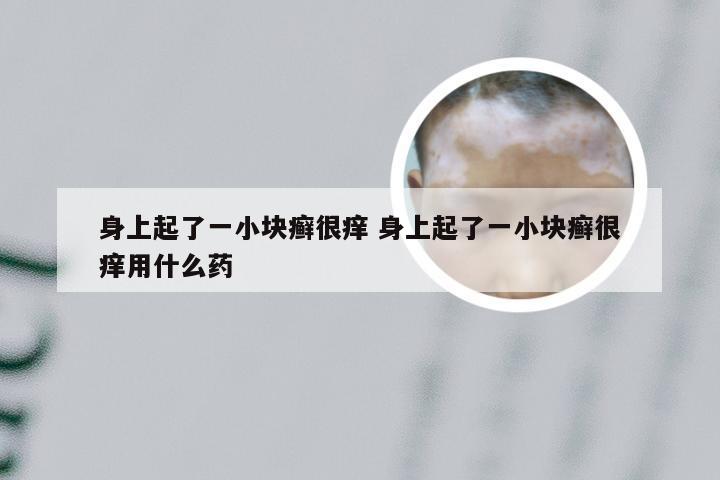 身上起了一小块癣很痒 身上起了一小块癣很痒用什么药