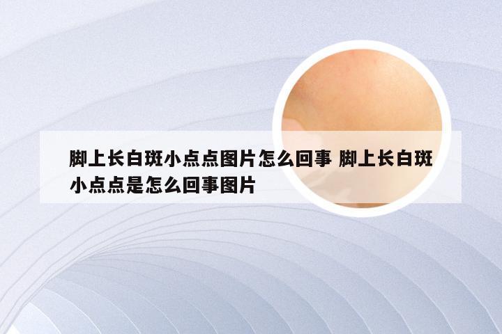脚上长白斑小点点图片怎么回事 脚上长白斑小点点是怎么回事图片