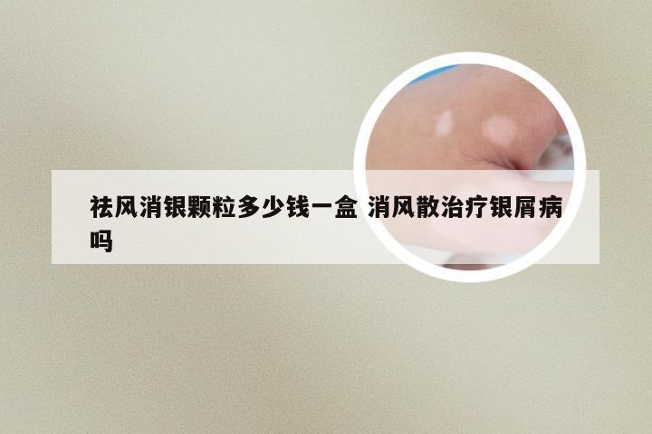 祛风消银颗粒多少钱一盒 消风散治疗银屑病吗