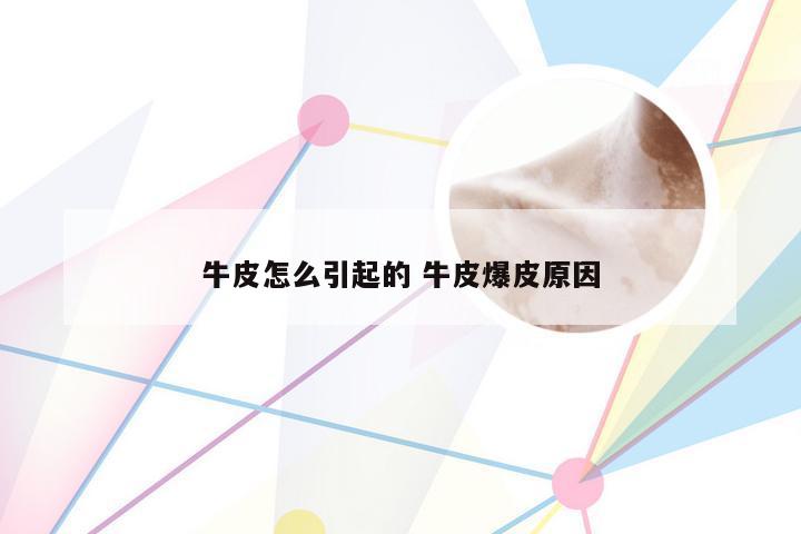 牛皮怎么引起的 牛皮爆皮原因