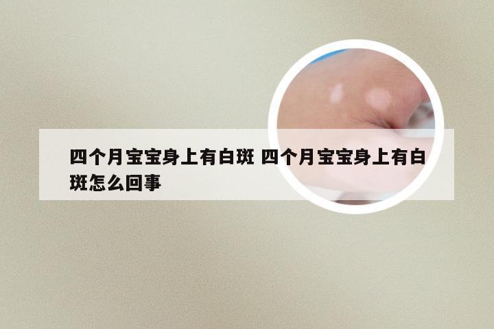 四个月宝宝身上有白斑 四个月宝宝身上有白斑怎么回事