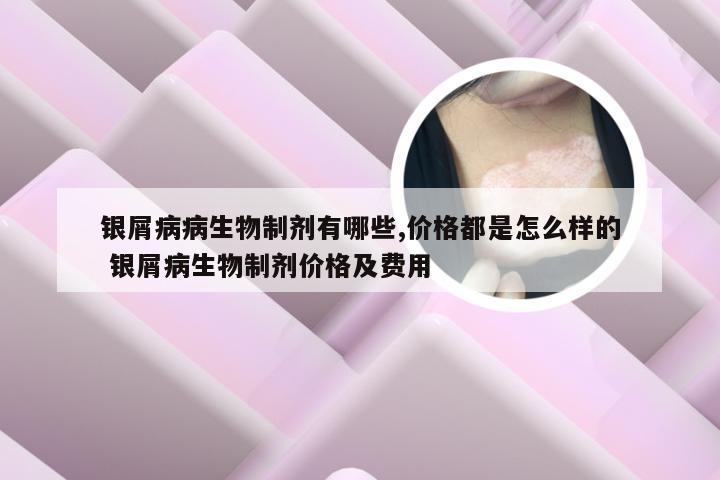银屑病病生物制剂有哪些,价格都是怎么样的 银屑病生物制剂价格及费用