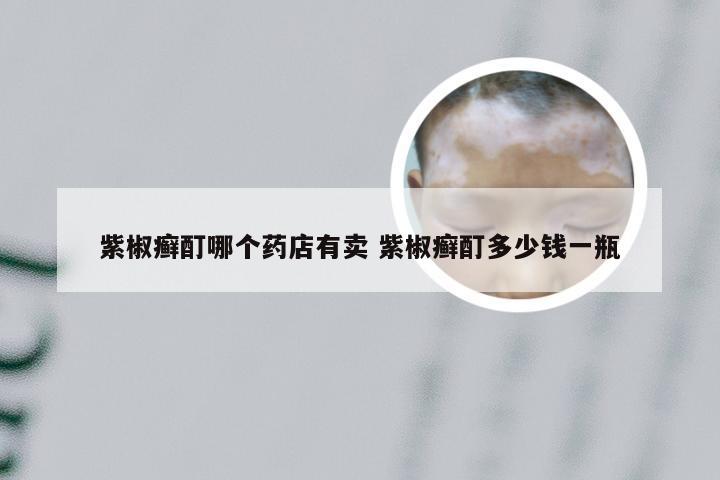 紫椒癣酊哪个药店有卖 紫椒癣酊多少钱一瓶