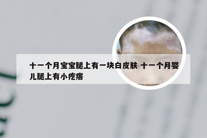 十一个月宝宝腿上有一块白皮肤 十一个月婴儿腿上有小疙瘩