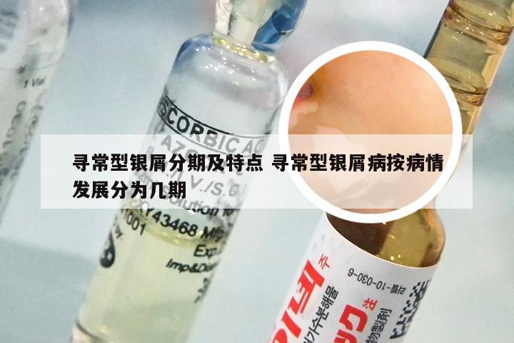 寻常型银屑分期及特点 寻常型银屑病按病情发展分为几期