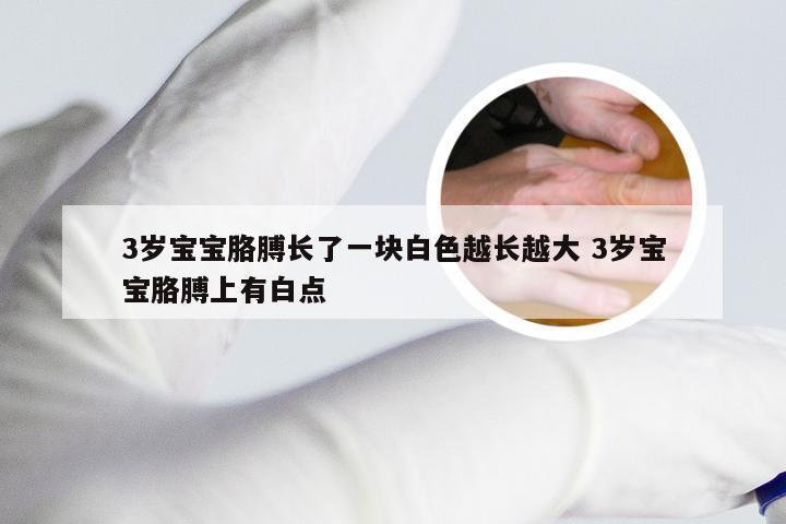 3岁宝宝胳膊长了一块白色越长越大 3岁宝宝胳膊上有白点