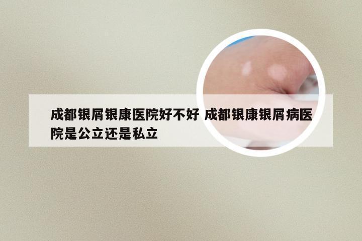成都银屑银康医院好不好 成都银康银屑病医院是公立还是私立