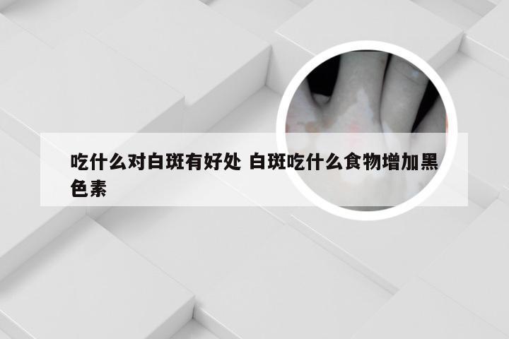 吃什么对白斑有好处 白斑吃什么食物增加黑色素