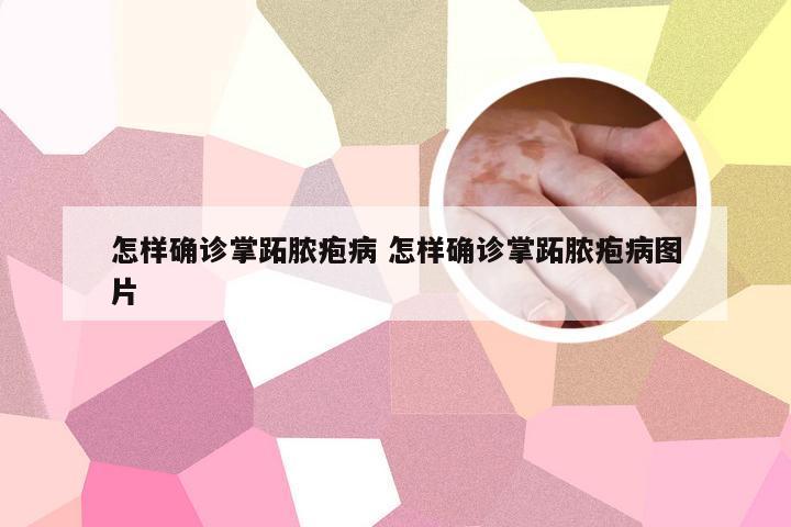 怎样确诊掌跖脓疱病 怎样确诊掌跖脓疱病图片