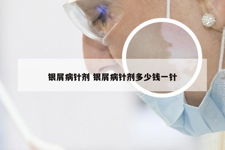 银屑病针剂 银屑病针剂多少钱一针