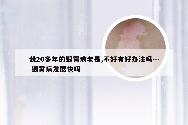 我20多年的银霄病老是,不好有好办法吗… 银霄病发展快吗