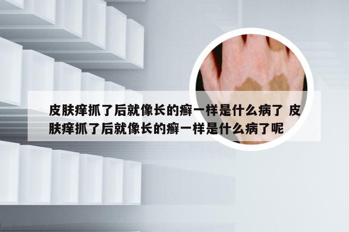 皮肤痒抓了后就像长的癣一样是什么病了 皮肤痒抓了后就像长的癣一样是什么病了呢