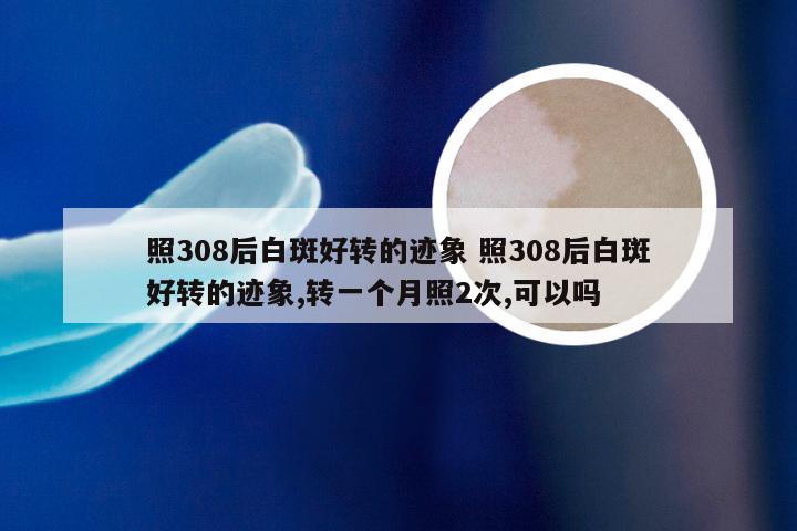 照308后白斑好转的迹象 照308后白斑好转的迹象,转一个月照2次,可以吗