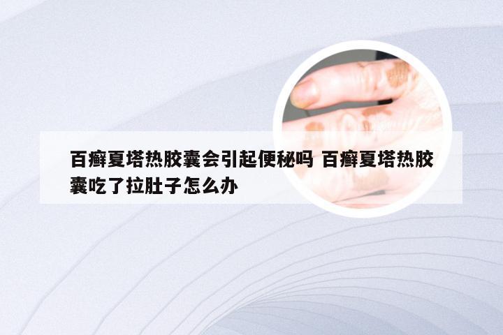 百癣夏塔热胶囊会引起便秘吗 百癣夏塔热胶囊吃了拉肚子怎么办