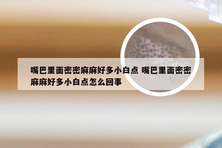 嘴巴里面密密麻麻好多小白点 嘴巴里面密密麻麻好多小白点怎么回事