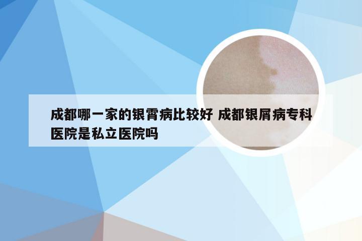 成都哪一家的银霄病比较好 成都银屑病专科医院是私立医院吗