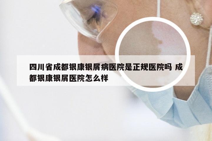 四川省成都银康银屑病医院是正规医院吗 成都银康银屑医院怎么样