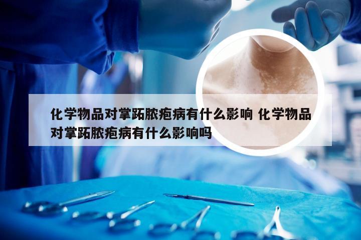 化学物品对掌跖脓疱病有什么影响 化学物品对掌跖脓疱病有什么影响吗