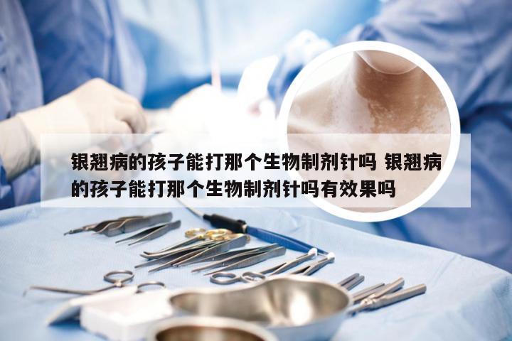 银翘病的孩子能打那个生物制剂针吗 银翘病的孩子能打那个生物制剂针吗有效果吗