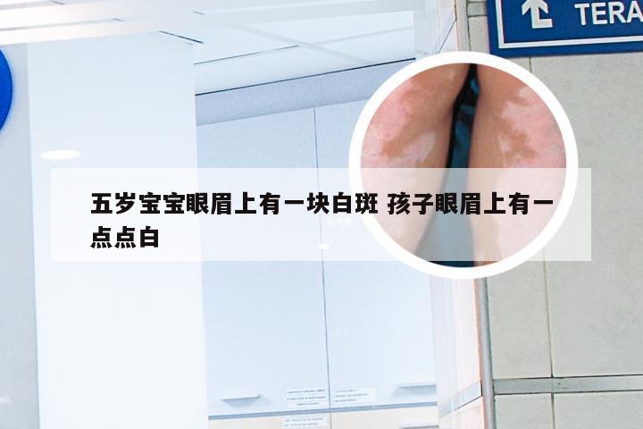 五岁宝宝眼眉上有一块白斑 孩子眼眉上有一点点白