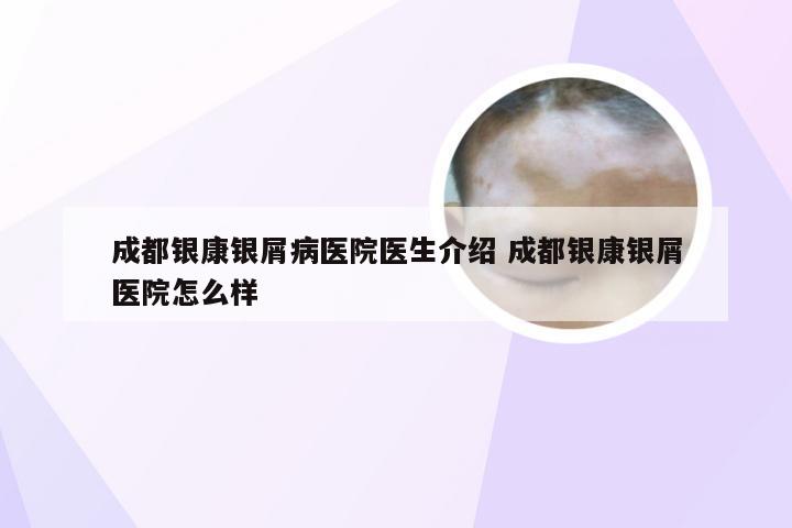 成都银康银屑病医院医生介绍 成都银康银屑医院怎么样