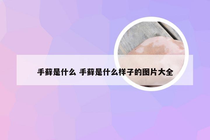 手藓是什么 手藓是什么样子的图片大全