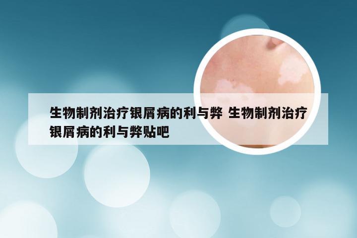 生物制剂治疗银屑病的利与弊 生物制剂治疗银屑病的利与弊贴吧
