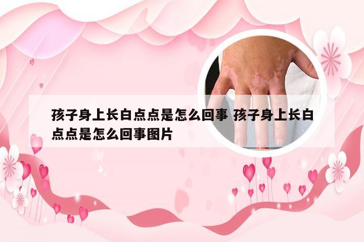 孩子身上长白点点是怎么回事 孩子身上长白点点是怎么回事图片
