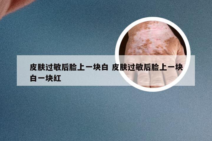 皮肤过敏后脸上一块白 皮肤过敏后脸上一块白一块红