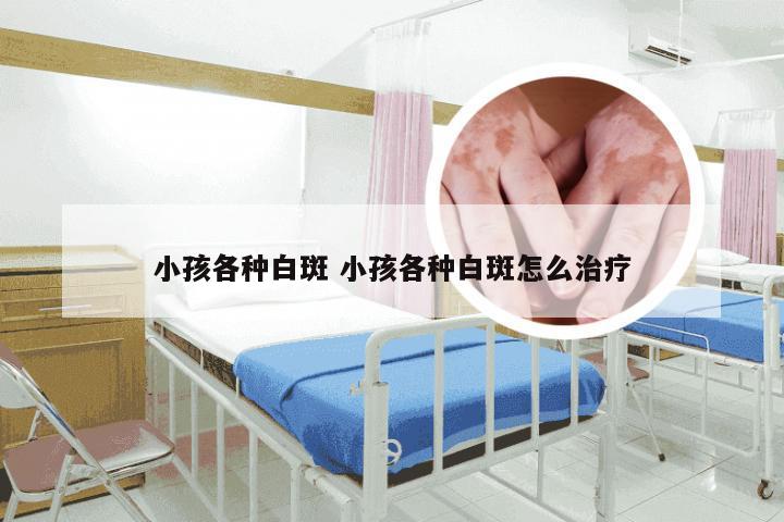 小孩各种白斑 小孩各种白斑怎么治疗