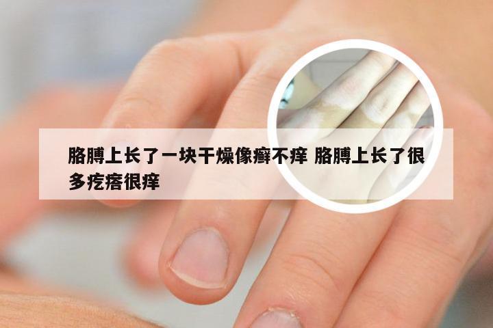 胳膊上长了一块干燥像癣不痒 胳膊上长了很多疙瘩很痒