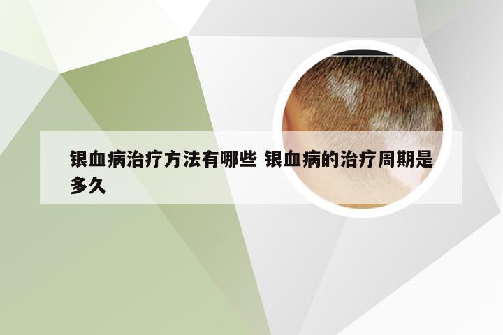 银血病治疗方法有哪些 银血病的治疗周期是多久