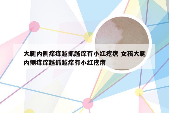 大腿内侧痒痒越抓越痒有小红疙瘩 女孩大腿内侧痒痒越抓越痒有小红疙瘩