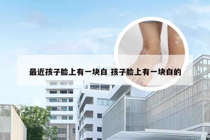 最近孩子脸上有一块白 孩子脸上有一块白的