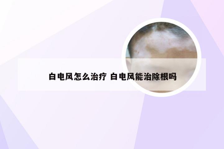 白电风怎么治疗 白电风能治除根吗