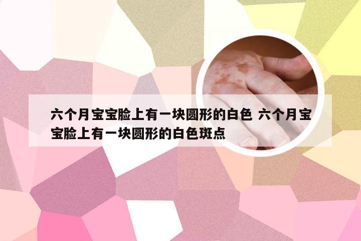 六个月宝宝脸上有一块圆形的白色 六个月宝宝脸上有一块圆形的白色斑点