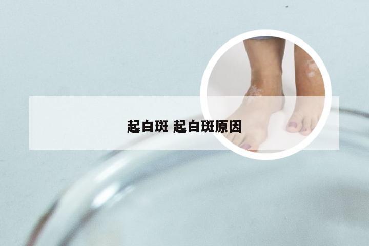 起白斑 起白斑原因