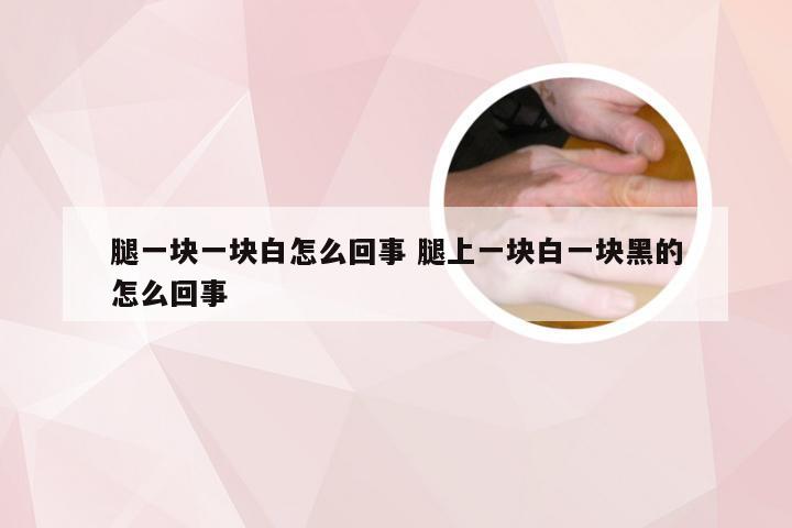 腿一块一块白怎么回事 腿上一块白一块黑的怎么回事