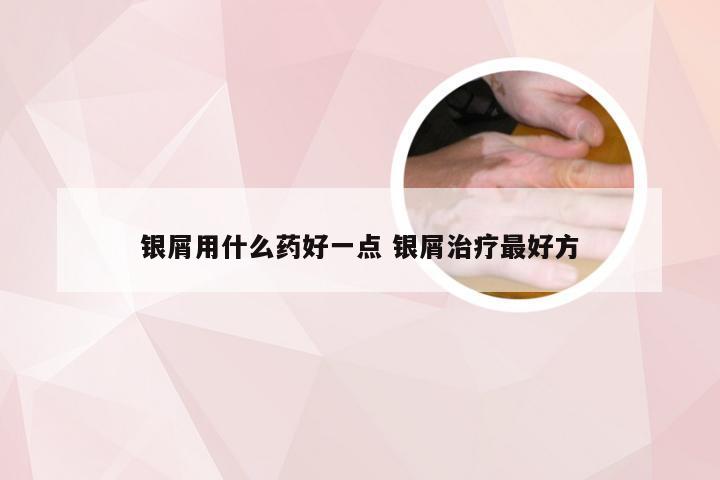 银屑用什么药好一点 银屑治疗最好方