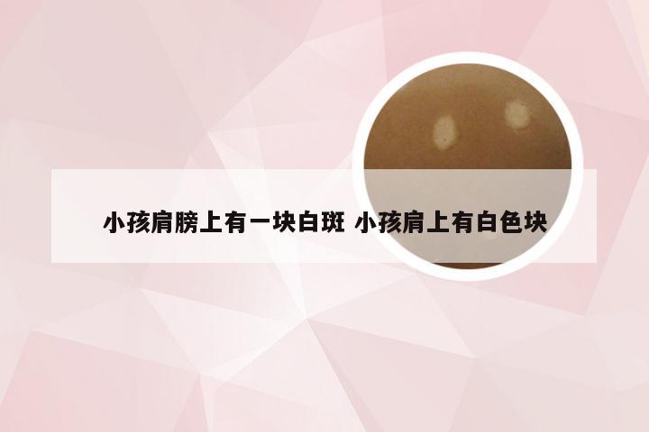 小孩肩膀上有一块白斑 小孩肩上有白色块