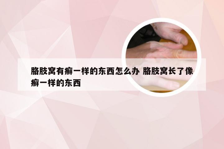 胳肢窝有癣一样的东西怎么办 胳肢窝长了像癣一样的东西