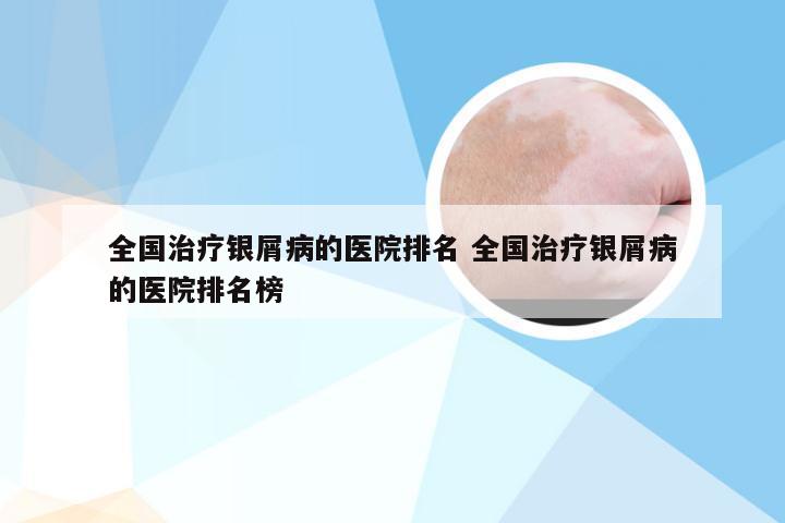 全国治疗银屑病的医院排名 全国治疗银屑病的医院排名榜
